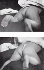 Human tail