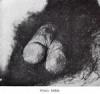 Penis bifide